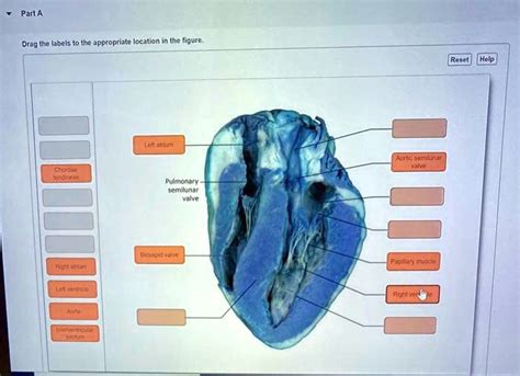 SOLVED: Drag the labels to the appropriate location in the figure. Reset [Help] Left atrium ...