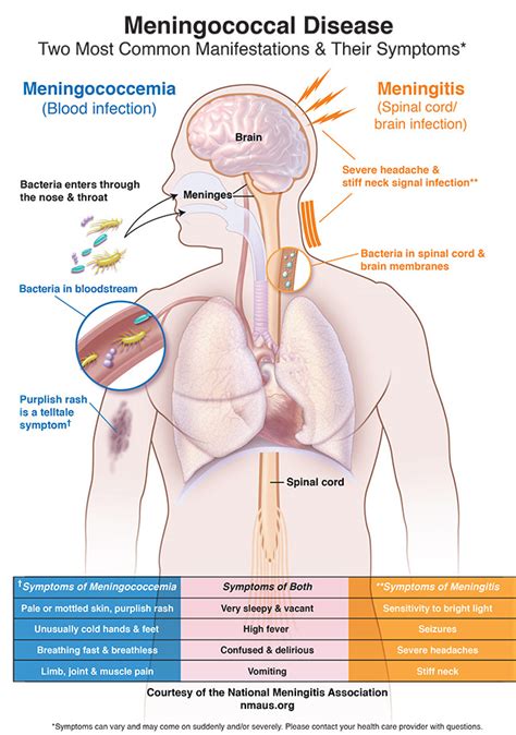 What are the symptoms? – National Meningitis Association