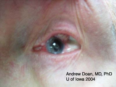 Ocular Trauma, assessment and management