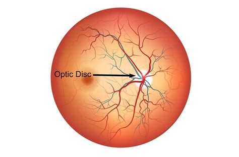 What Is the Optic Disc? - Medical Definition