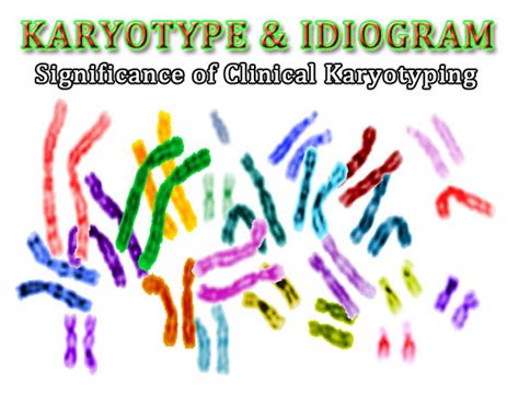 Karyotype Analysis of Human Chromosome | EasyBiologyClass