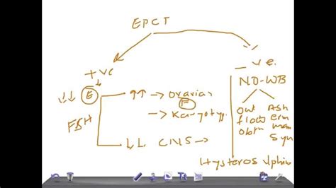 QUICK OBGYN: Estrogen-Progesterone Challenge Test (EPCT) - YouTube