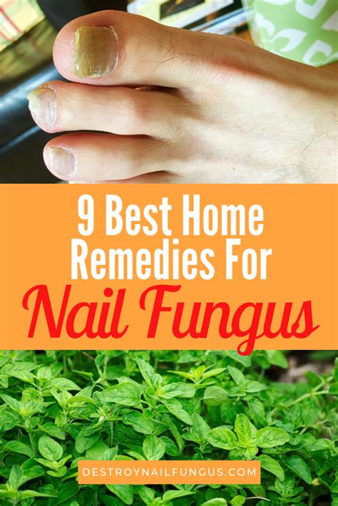 9 Best Home Remedies For Nail Fungus: What Really Works? | Nail fungus remedy, Nail fungus, Home ...