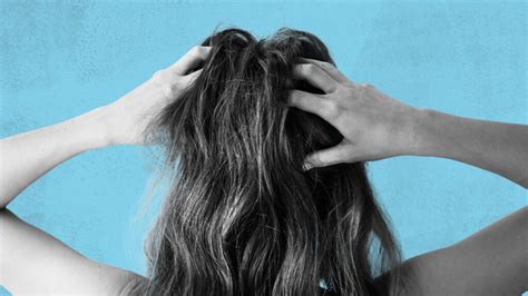 Itchy scalp and hair loss: Link, causes, and treatment