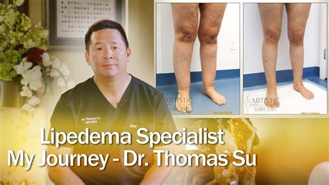 Lipedema Surgery Liposuction | Expert Dr. Thomas Su | ArtLipo - YouTube