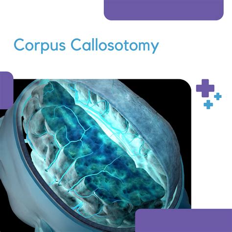 Corpus Callosotomy - LGS Foundation