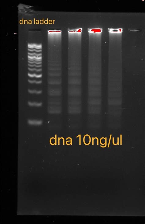 425 questions with answers in DNA AMPLIFICATION | Scientific method