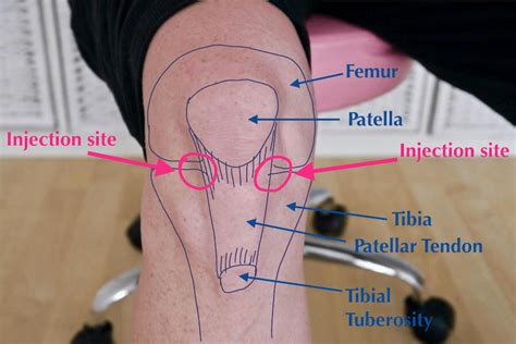 The Knee Joint Anatomy