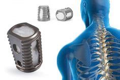 80 Bone stimulator ideas | bone healing, stimulation, orthopedic cast