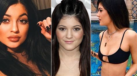 Plastic Surgeons Weigh In On Kylie Jenner's Dramatic Transformation—Did She Go Under The Knife?