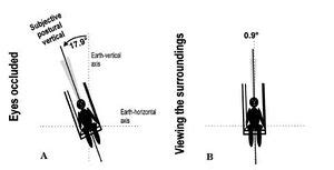 Pusher Syndrome - Physiopedia