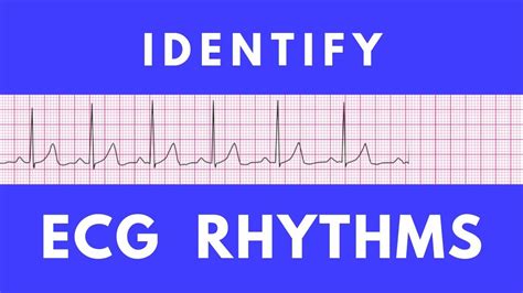 Ecg Rhythms In Acls By Dr Ahmed Sobhy Youtube | sexiezpix Web Porn