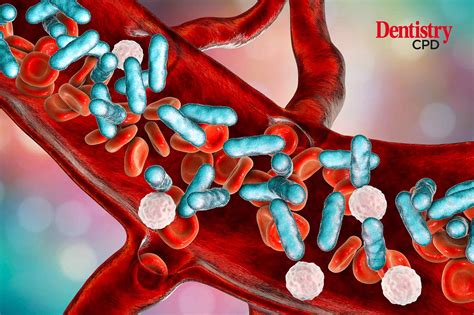 Dentistry CPD - A guide to sepsis