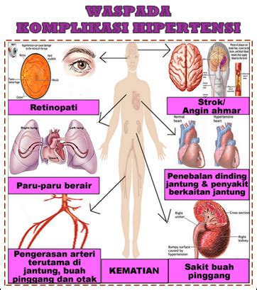 Hipertensi (Tekanan Darah Tinggi) | RS Cahya Kawaluyan