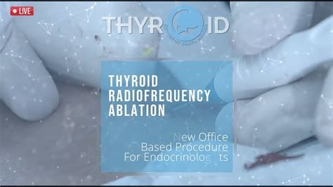 Thyroid RFA Ablation Master Course - YouTube