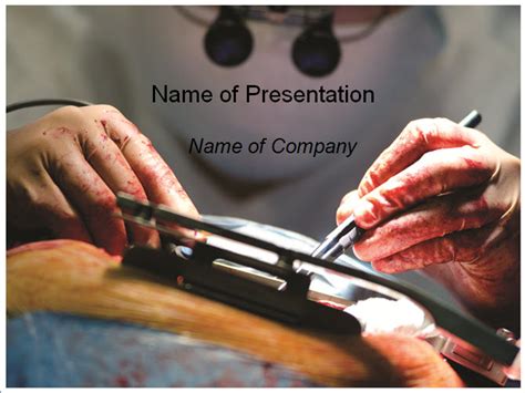 Cardiac surgery powerpoint template (ppt slides) download 21 slide