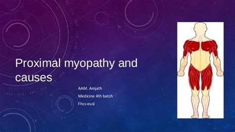 Proximal myopathy and causes