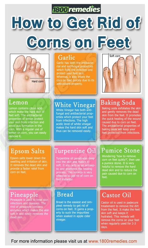 Pin by Natural Remedies * on Home Remedies | Get rid of corns, Foot remedies, Corn removal