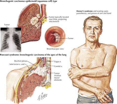 Thorax | Basicmedical Key