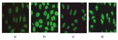 a) Homogeneous b) Speckled c) Centromere and d) Nucleolar ANA IFA... | Download Scientific Diagram