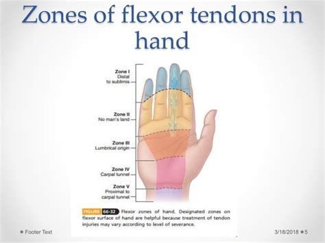 Flexor tendon injuries