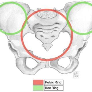 Anatomy of the iliac wing potentially involved in fractures are: iliac ...