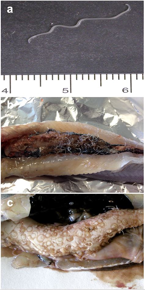 Anisakis simplex in the second intermediate/ paratenic host blue... | Download Scientific Diagram