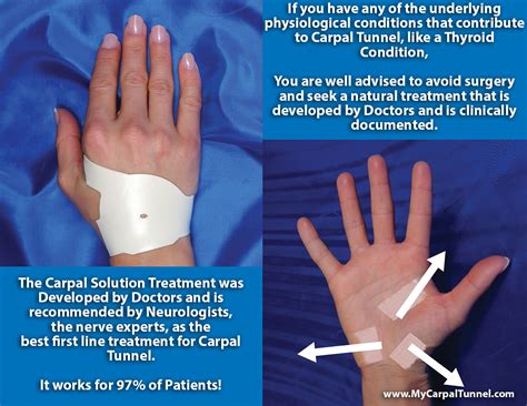 With a Thyroid Condition, is Carpal Tunnel Surgery Recommended?