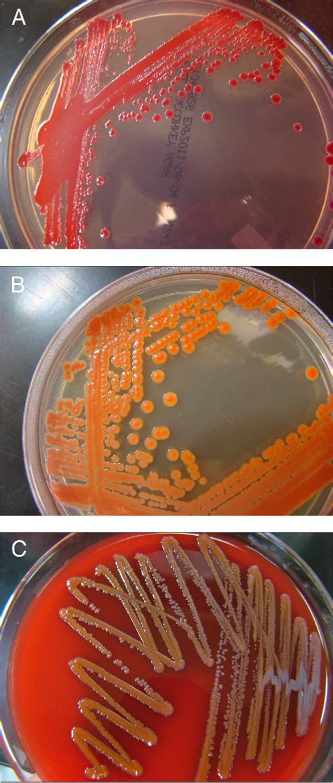 Serratia marcescens | Semantic Scholar