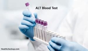 Alt Blood Test- Procedure, Preparation, And Results