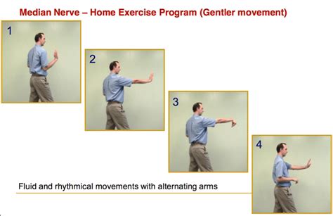 Do You Have Carpal Tunnel Syndrome and How to Manage It Yourself