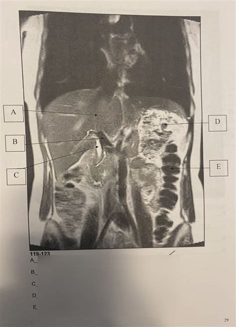 MRI Abdomen Anatomy 4 Diagram | Quizlet