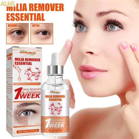 Milia Remover Essential Eye Serum Effective Removes Fat Granules eye ...