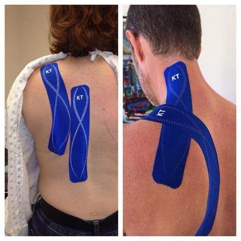 How To Apply Kt Tape To Shoulder Blade