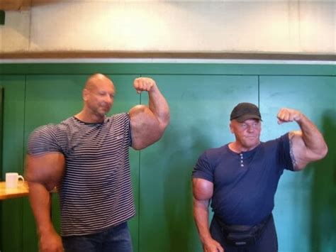 Bodybuilding blog: The consequences of synthol use