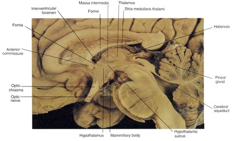 subthalamus - Google Search Cranial Anatomy, Human Anatomy And Physiology, Types Of Facial ...