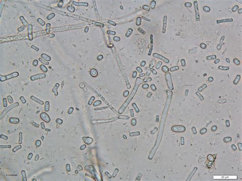 Geotrichum