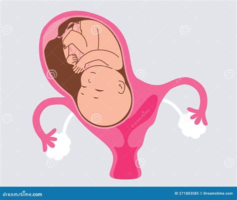 Bicornuate Uterus during Pregnancy with Baby Stock Vector - Illustration of anatomy, gynecology ...