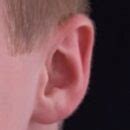 Ear Infections in Children: Identifying and Treating | Ask Dr Sears