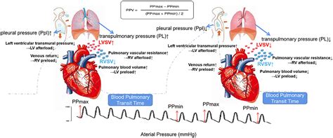 Frontiers | PPV May Be a Starting Point to Achieve Circulatory Protective Mechanical Ventilation