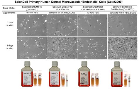 Why is basal media and supplementation important in primary cell culture? - ScienCell Research ...