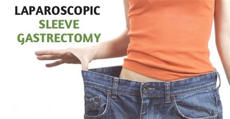 Laparoscopic Sleeve Gastrectomy - Weight Loss Surgery in Peru