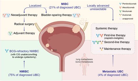 Tuberculosis treatment for bladder cancer | doctorvisit