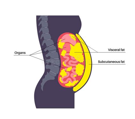 Visceral fat diagram stock vector. Illustration of abdominal - 281039679