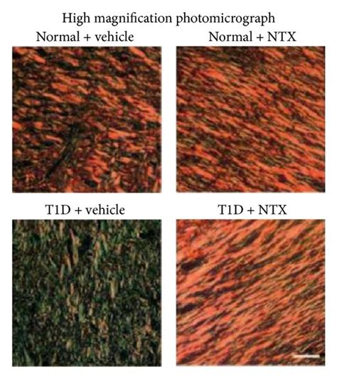 Sirius red-stained healing skin. Diminished collagen formation and... | Download Scientific Diagram