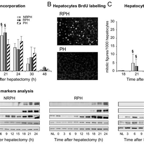 S-phase cell cycle markers are expressed earlier in RPH and NRPH ...