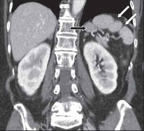 Imaging of the spleen: what the clinician needs to know | SMJ