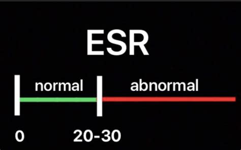 Does Elevated ESR cause Hair Loss? — Donovan Hair Clinic