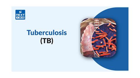 Tuberculosis (TB): Facts, Symptoms, Diagnosis, MDR-TB & Impact