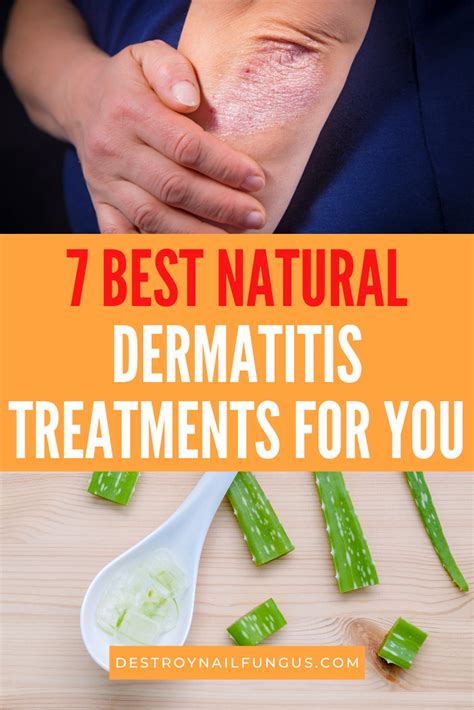 Dermatitis Remedies: Natural Treatments For Eczema Relief